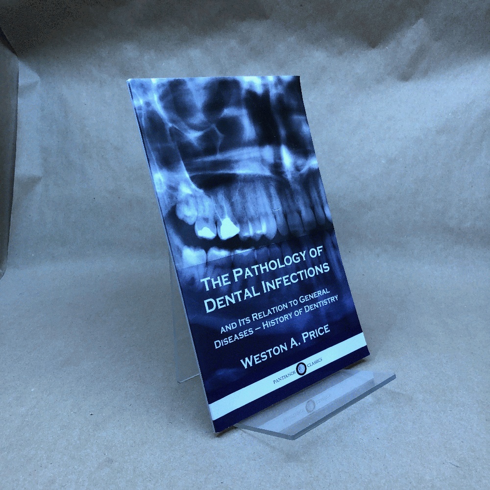 The Pathology of Dental Infections: and Its Relation to General Diseases - History of Dentistry